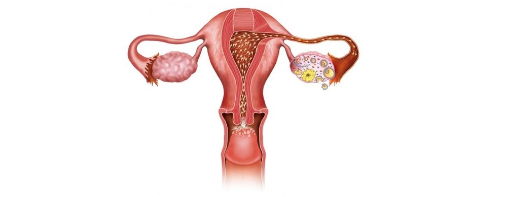 Сальпингит: как не пропустить тревожные сигналы и восстановить здоровье вовремя